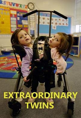 连体双胞胎 第一季 Extraordinary Twins Season 1 (2020)海报